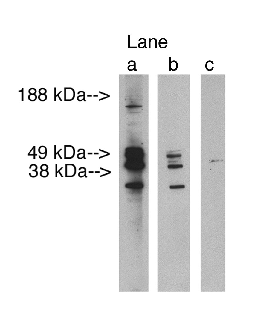 "
Western blot analysis using LAG1 longevity assurance homolog 3(Cat. X2304P) at 2.5 µg/ml on human testis lysate 14 µg/lane.  Lane A] antibody alone, Lane B] antibody blocked with 40 µg blocking peptide. Lane C] conjugate alone. Visualized using Pierce West Femto substrate system.  Anti Rabbit secondary used at dilution used 1:3.5K (Cat. # X1207M). Exposure for 3 minutes"
